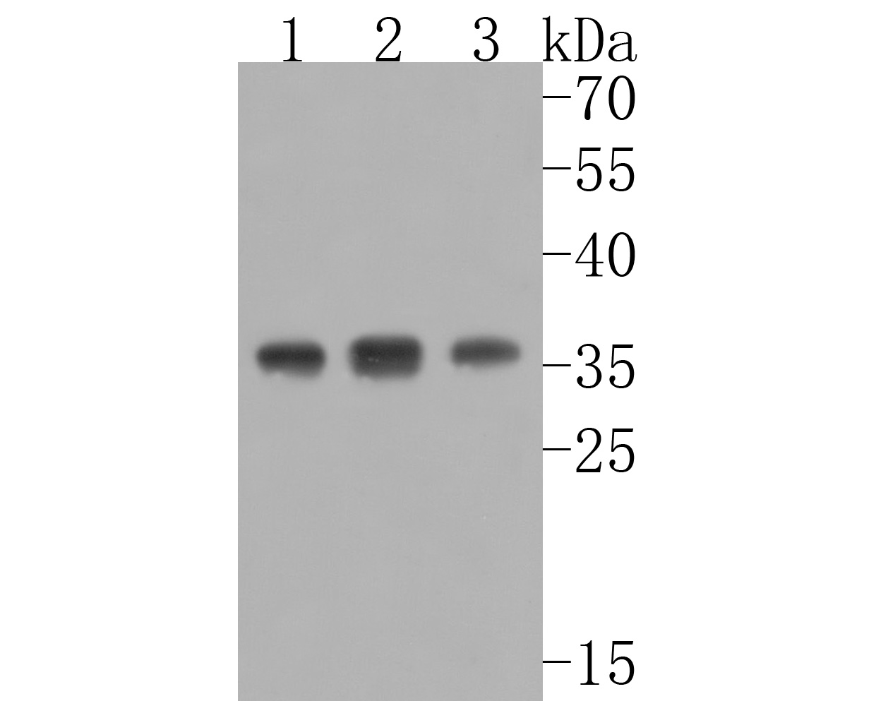 Western blot analysis of MED4 on different lysates. Proteins were transferred to a PVDF membrane and blocked with 5% BSA in PBS for 1 hour at room temperature. The primary antibody (HA720007, 1/500) was used in 5% BSA at room temperature for 2 hours. Goat Anti-Rabbit IgG - HRP Secondary Antibody (HA1001) at 1:5,000 dilution was used for 1 hour at room temperature.<br />
Positive control: <br />
Lane 1: SH-SY5Y cell lysate<br />
Lane 2: Rat testis tissue lysate<br />
Lane 3: Mouse thymus tissue lysate