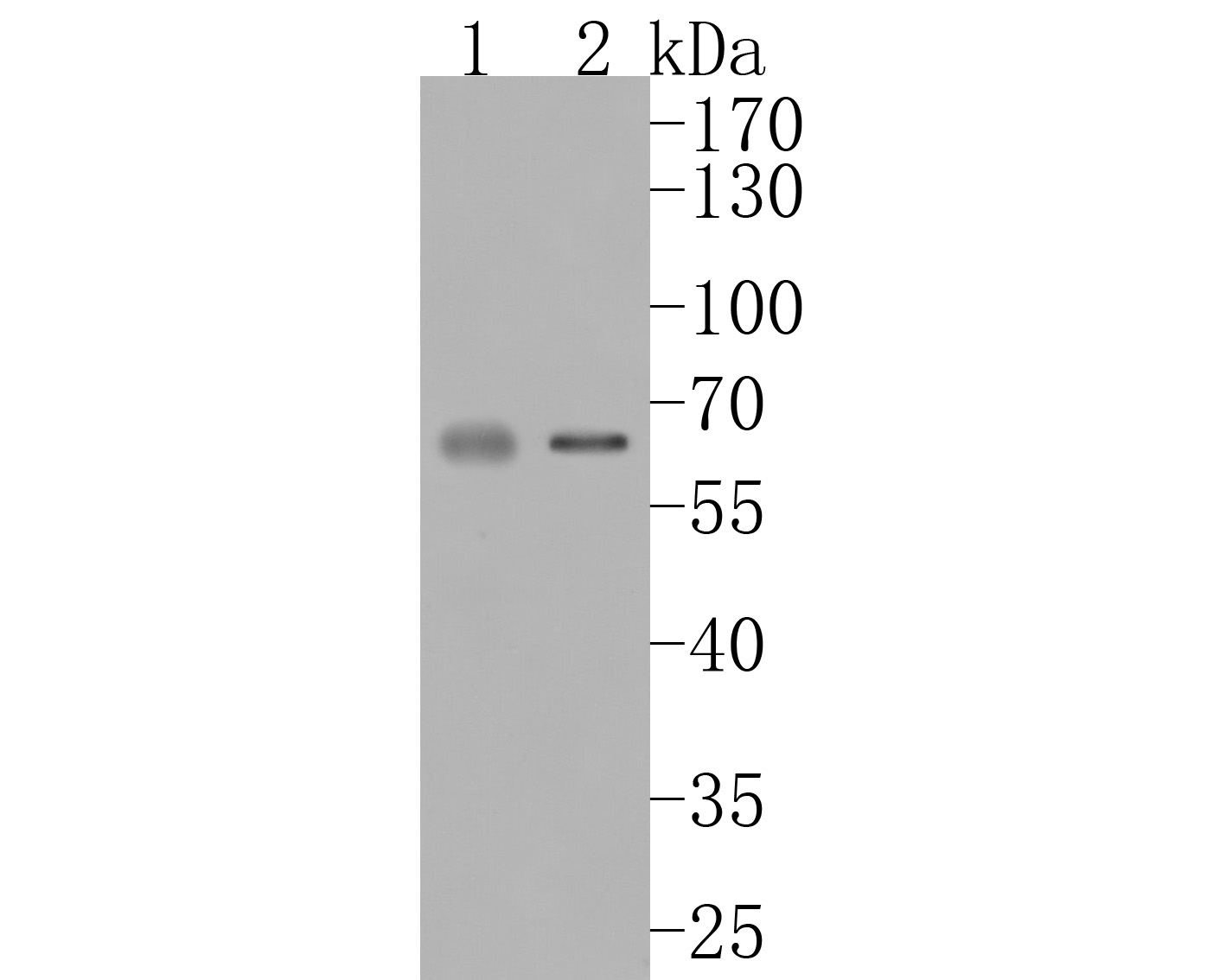 Western blot analysis of Sulfite oxidase on different lysates. Proteins were transferred to a PVDF membrane and blocked with 5% BSA in PBS for 1 hour at room temperature. The primary antibody (HA720008, 1/500) was used in 5% BSA at room temperature for 2 hours. Goat Anti-Rabbit IgG - HRP Secondary Antibody (HA1001) at 1:5,000 dilution was used for 1 hour at room temperature.<br />
Positive control: <br />
Lane 1: Human kidney tissue lysate<br />
Lane 2: B16F1 cell lysate