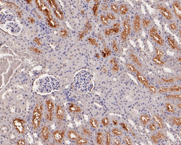 Immunohistochemical analysis of paraffin-embedded rat kidney tissue using anti-Sulfite oxidase antibody. The section was pre-treated using heat mediated antigen retrieval with Tris-EDTA buffer (pH 8.0-8.4) for 20 minutes.The tissues were blocked in 5% BSA for 30 minutes at room temperature, washed with ddH2O and PBS, and then probed with the primary antibody (HA720008, 1/50) for 30 minutes at room temperature. The detection was performed using an HRP conjugated compact polymer system. DAB was used as the chromogen. Tissues were counterstained with hematoxylin and mounted with DPX.