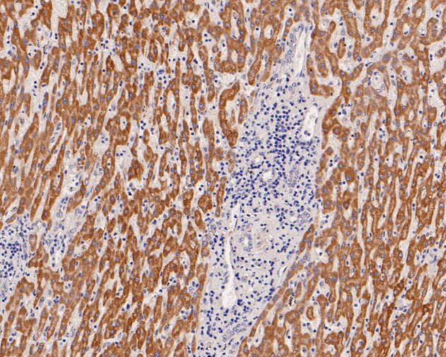 Immunohistochemical analysis of paraffin-embedded human liver tissue using anti-Sulfite oxidase antibody. The section was pre-treated using heat mediated antigen retrieval with Tris-EDTA buffer (pH 8.0-8.4) for 20 minutes.The tissues were blocked in 5% BSA for 30 minutes at room temperature, washed with ddH2O and PBS, and then probed with the primary antibody (HA720008, 1/200) for 30 minutes at room temperature. The detection was performed using an HRP conjugated compact polymer system. DAB was used as the chromogen. Tissues were counterstained with hematoxylin and mounted with DPX.