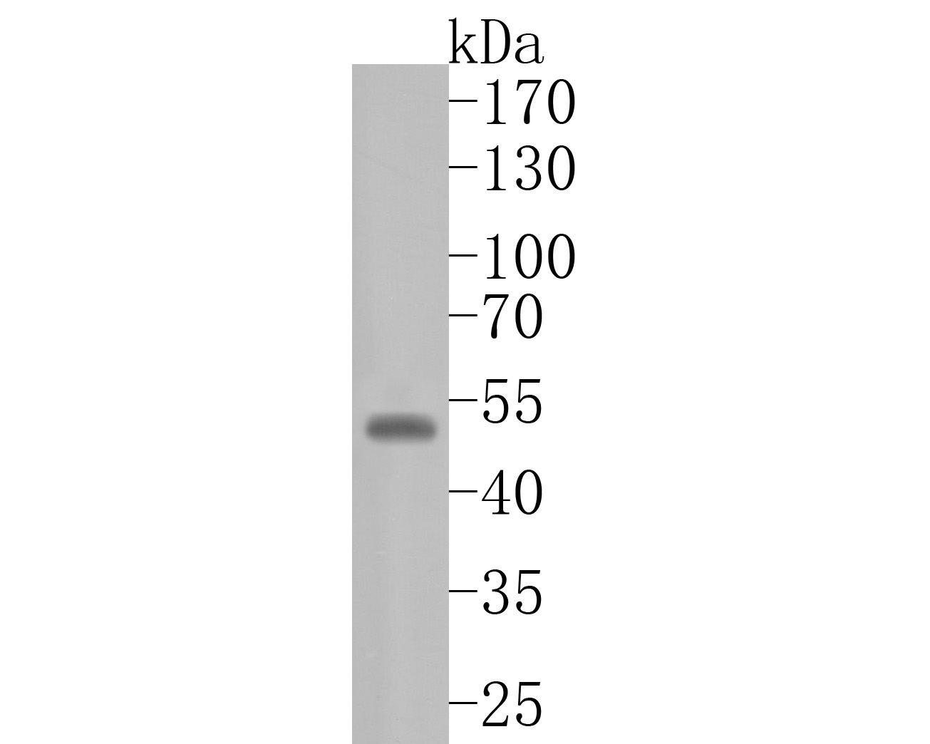 Western blot analysis of WIPI1 on JAR cell lysates. Proteins were transferred to a PVDF membrane and blocked with 5% BSA in PBS for 1 hour at room temperature. The primary antibody (HA720010, 1/500) was used in 5% BSA at room temperature for 2 hours. Goat Anti-Rabbit IgG - HRP Secondary Antibody (HA1001) at 1:5,000 dilution was used for 1 hour at room temperature.