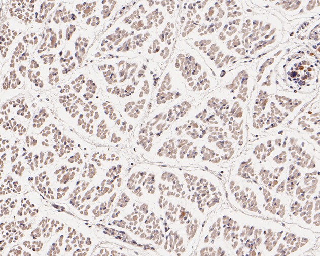 Immunohistochemical analysis of paraffin-embedded human fetal skeletal muscle tissue using anti-WIPI1 antibody. The section was pre-treated using heat mediated antigen retrieval with Tris-EDTA buffer (pH 8.0-8.4) for 20 minutes.The tissues were blocked in 5% BSA for 30 minutes at room temperature, washed with ddH2O and PBS, and then probed with the primary antibody (HA720010, 1/50) for 30 minutes at room temperature. The detection was performed using an HRP conjugated compact polymer system. DAB was used as the chromogen. Tissues were counterstained with hematoxylin and mounted with DPX.
