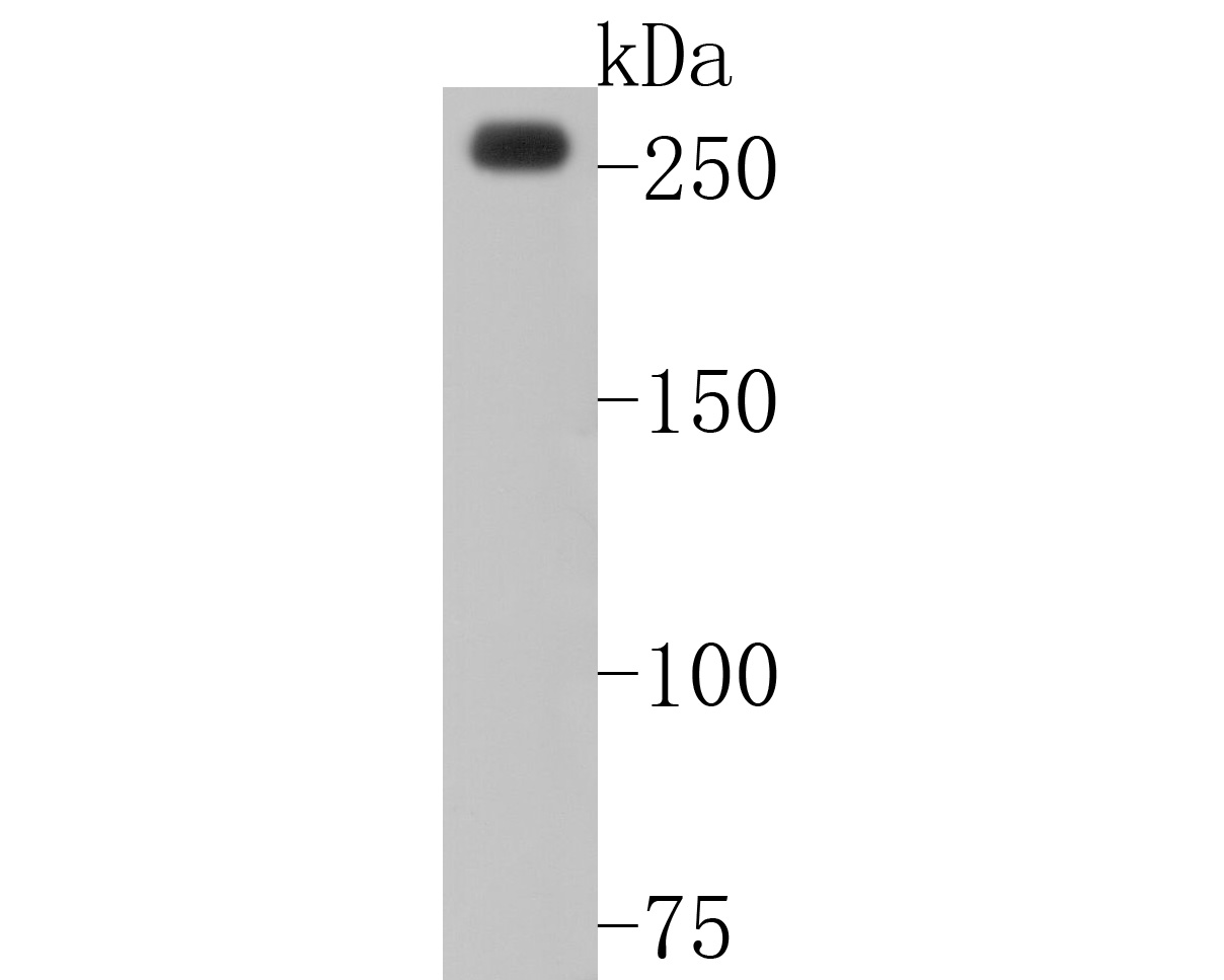 Western blot analysis of CHD3 on SiHa cell lysates. Proteins were transferred to a PVDF membrane and blocked with 5% BSA in PBS for 1 hour at room temperature. The primary antibody (HA720011, 1/500) was used in 5% BSA at room temperature for 2 hours. Goat Anti-Rabbit IgG - HRP Secondary Antibody (HA1001) at 1:5,000 dilution was used for 1 hour at room temperature.