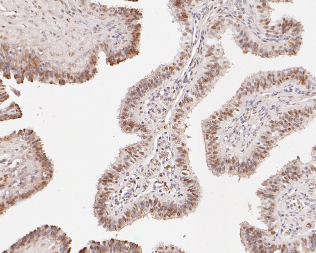 Immunohistochemical analysis of paraffin-embedded human fallopian tube tissue using anti-CHD3 antibody. The section was pre-treated using heat mediated antigen retrieval with sodium citrate buffer (pH 6.0) for 20 minutes. The tissues were blocked in 5% BSA for 30 minutes at room temperature, washed with ddH2O and PBS, and then probed with the primary antibody (HA720011, 1/200)  for 30 minutes at room temperature. The detection was performed using an HRP conjugated compact polymer system. DAB was used as the chromogen. Tissues were counterstained with hematoxylin and mounted with DPX.