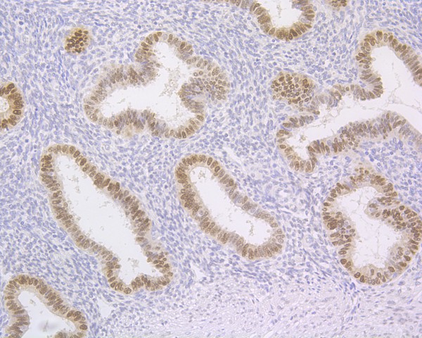 Immunohistochemical analysis of paraffin-embedded human uterus tissue using anti-CHD3 antibody. The section was pre-treated using heat mediated antigen retrieval with sodium citrate buffer (pH 6.0) for 20 minutes. The tissues were blocked in 5% BSA for 30 minutes at room temperature, washed with ddH2O and PBS, and then probed with the primary antibody (HA720011, 1/500)  for 30 minutes at room temperature. The detection was performed using an HRP conjugated compact polymer system. DAB was used as the chromogen. Tissues were counterstained with hematoxylin and mounted with DPX.