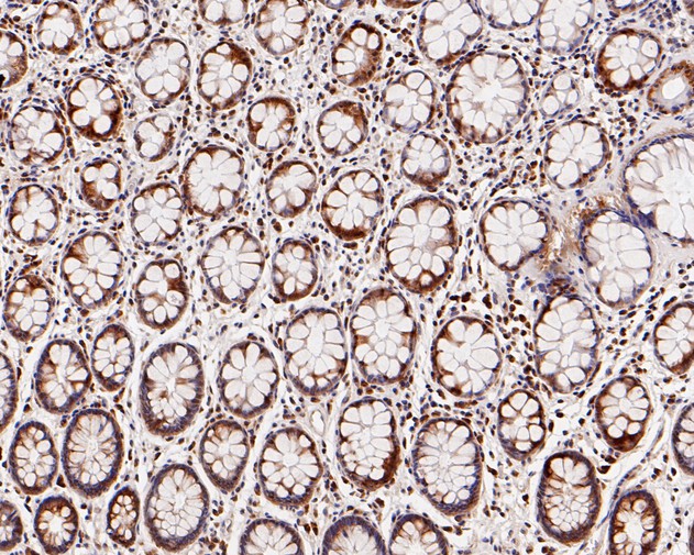 Immunohistochemical analysis of paraffin-embedded human colon tissue using anti-SBDS antibody. The section was pre-treated using heat mediated antigen retrieval with sodium citrate buffer (pH 6.0) for 20 minutes. The tissues were blocked in 5% BSA for 30 minutes at room temperature, washed with ddH2O and PBS, and then probed with the primary antibody (HA720012, 1/200)  for 30 minutes at room temperature. The detection was performed using an HRP conjugated compact polymer system. DAB was used as the chromogen. Tissues were counterstained with hematoxylin and mounted with DPX.