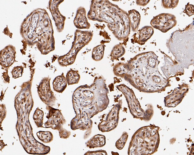 Immunohistochemical analysis of paraffin-embedded human placenta tissue using anti-SBDS antibody. The section was pre-treated using heat mediated antigen retrieval with sodium citrate buffer (pH 6.0) for 20 minutes. The tissues were blocked in 5% BSA for 30 minutes at room temperature, washed with ddH2O and PBS, and then probed with the primary antibody (HA720012, 1/200)  for 30 minutes at room temperature. The detection was performed using an HRP conjugated compact polymer system. DAB was used as the chromogen. Tissues were counterstained with hematoxylin and mounted with DPX.