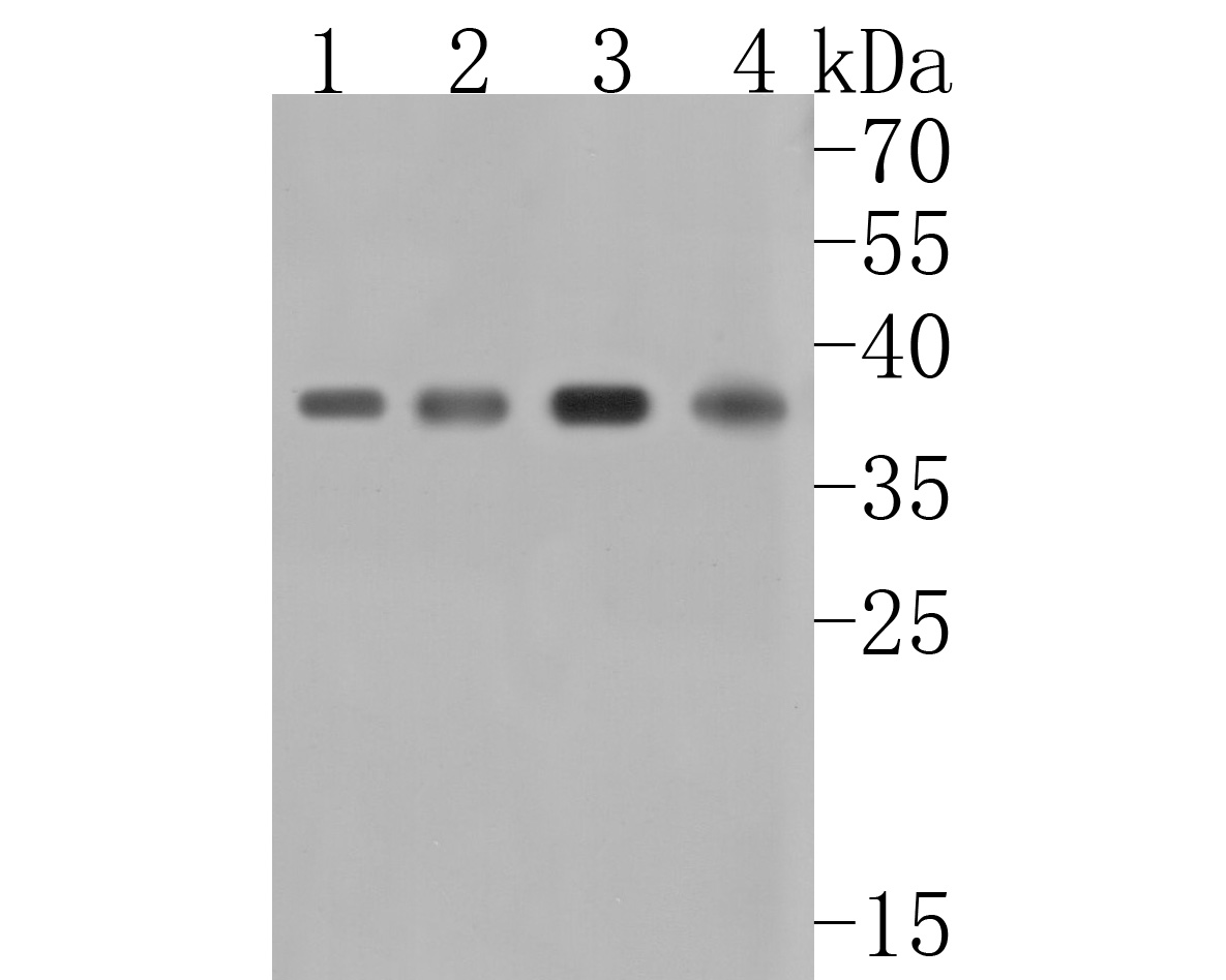 Western blot analysis of HDGF on different lysates. Proteins were transferred to a PVDF membrane and blocked with 5% BSA in PBS for 1 hour at room temperature. The primary antibody (HA720013, 1/500) was used in 5% BSA at room temperature for 2 hours. Goat Anti-Rabbit IgG - HRP Secondary Antibody (HA1001) at 1:5,000 dilution was used for 1 hour at room temperature.<br />
Positive control: <br />
Lane 1: 293T cell lysate<br />
Lane 2: Hela cell lysate<br />
Lane 3: SK-Br-3 cell lysate<br />
Lane 4: Mouse lung tissue lysate