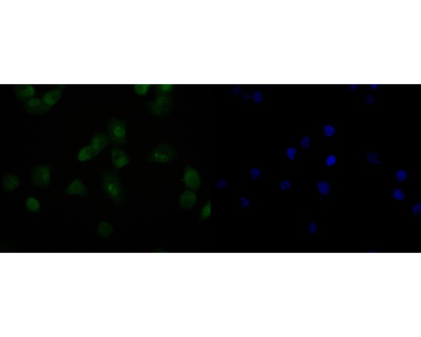 ICC staining of HDGF in PANC-1 cells (green). Formalin fixed cells were permeabilized with 0.1% Triton X-100 in TBS for 10 minutes at room temperature and blocked with 1% Blocker BSA for 15 minutes at room temperature. Cells were probed with the primary antibody (HA720013, 1/50) for 1 hour at room temperature, washed with PBS. Alexa Fluor®488 Goat anti-Rabbit IgG was used as the secondary antibody at 1/1,000 dilution. The nuclear counter stain is DAPI (blue).