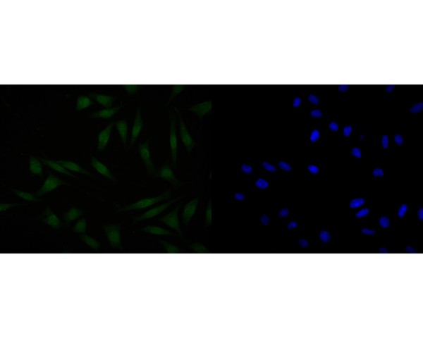 ICC staining of HDGF in SH-SY5Y cells (green). Formalin fixed cells were permeabilized with 0.1% Triton X-100 in TBS for 10 minutes at room temperature and blocked with 1% Blocker BSA for 15 minutes at room temperature. Cells were probed with the primary antibody (HA720013, 1/50) for 1 hour at room temperature, washed with PBS. Alexa Fluor®488 Goat anti-Rabbit IgG was used as the secondary antibody at 1/1,000 dilution. The nuclear counter stain is DAPI (blue).