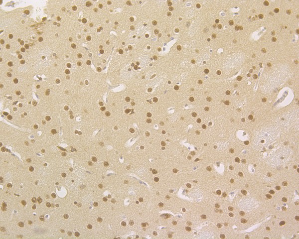 Immunohistochemical analysis of paraffin-embedded rat brain tissue using anti-HDGF antibody. The section was pre-treated using heat mediated antigen retrieval with sodium citrate buffer (pH 6.0) for 20 minutes. The tissues were blocked in 5% BSA for 30 minutes at room temperature, washed with ddH2O and PBS, and then probed with the primary antibody (HA720013, 1/500)  for 30 minutes at room temperature. The detection was performed using an HRP conjugated compact polymer system. DAB was used as the chromogen. Tissues were counterstained with hematoxylin and mounted with DPX.