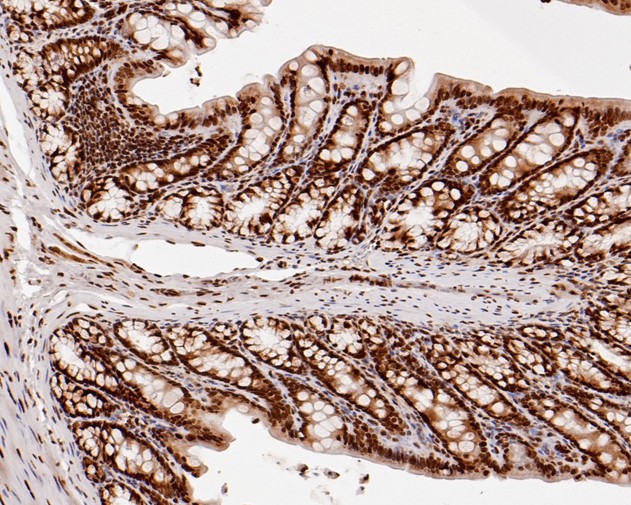 Immunohistochemical analysis of paraffin-embedded rat large intestine tissue using anti-HDGF antibody. The section was pre-treated using heat mediated antigen retrieval with sodium citrate buffer (pH 6.0) for 20 minutes. The tissues were blocked in 5% BSA for 30 minutes at room temperature, washed with ddH2O and PBS, and then probed with the primary antibody (HA720013, 1/200)  for 30 minutes at room temperature. The detection was performed using an HRP conjugated compact polymer system. DAB was used as the chromogen. Tissues were counterstained with hematoxylin and mounted with DPX.