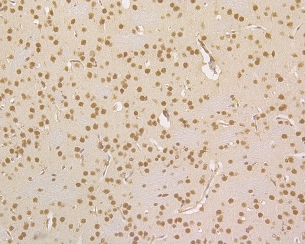 Immunohistochemical analysis of paraffin-embedded mouse brain tissue using anti-HDGF antibody. The section was pre-treated using heat mediated antigen retrieval with sodium citrate buffer (pH 6.0) for 20 minutes. The tissues were blocked in 5% BSA for 30 minutes at room temperature, washed with ddH2O and PBS, and then probed with the primary antibody (HA720013, 1/500)  for 30 minutes at room temperature. The detection was performed using an HRP conjugated compact polymer system. DAB was used as the chromogen. Tissues were counterstained with hematoxylin and mounted with DPX.