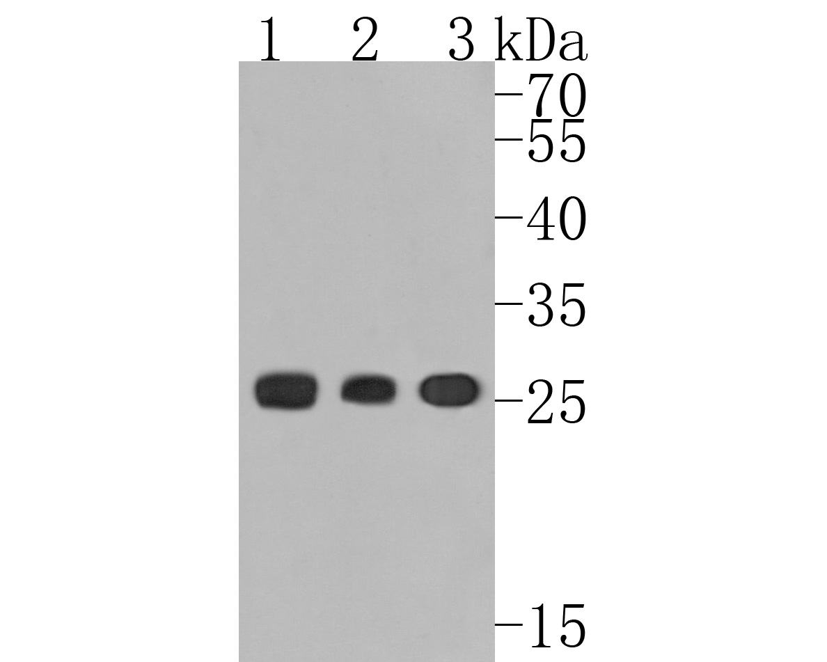 Immunohistochemical analysis of paraffin-embedded human tonsil tissue using anti-Human Kappa light chain antibody. The section was pre-treated using heat mediated antigen retrieval with Tris-EDTA buffer (pH 8.0-8.4) for 20 minutes.The tissues were blocked in 5% BSA for 30 minutes at room temperature, washed with ddH2O and PBS, and then probed with the primary antibody (HA720014, 1/50) for 30 minutes at room temperature. The detection was performed using an HRP conjugated compact polymer system. DAB was used as the chromogen. Tissues were counterstained with hematoxylin and mounted with DPX.
