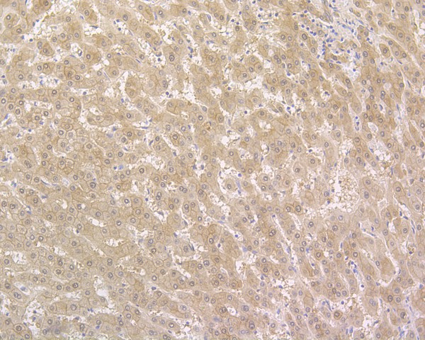 Immunohistochemical analysis of paraffin-embedded human liver tissue using anti-NUDT5 antibody. The section was pre-treated using heat mediated antigen retrieval with sodium citrate buffer (pH 6.0) for 20 minutes. The tissues were blocked in 5% BSA for 30 minutes at room temperature, washed with ddH2O and PBS, and then probed with the primary antibody (HA720015, 1/500)  for 30 minutes at room temperature. The detection was performed using an HRP conjugated compact polymer system. DAB was used as the chromogen. Tissues were counterstained with hematoxylin and mounted with DPX.