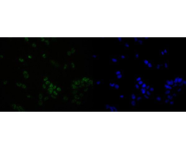 ICC staining of Olig3 in F9 cells (green). Formalin fixed cells were permeabilized with 0.1% Triton X-100 in TBS for 10 minutes at room temperature and blocked with 1% Blocker BSA for 15 minutes at room temperature. Cells were probed with the primary antibody (HA720016, 1/50) for 1 hour at room temperature, washed with PBS. Alexa Fluor®488 Goat anti-Rabbit IgG was used as the secondary antibody at 1/1,000 dilution. The nuclear counter stain is DAPI (blue).