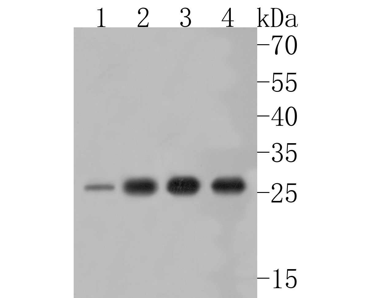 Western blot analysis of Uridine Phosphorylase 1 on different lysates. Proteins were transferred to a PVDF membrane and blocked with 5% BSA in PBS for 1 hour at room temperature. The primary antibody (HA720018, 1/500) was used in 5% BSA at room temperature for 2 hours. Goat Anti-Rabbit IgG - HRP Secondary Antibody (HA1001) at 1:5,000 dilution was used for 1 hour at room temperature.<br />
Positive control: <br />
Lane 1: A431 cell lysate<br />
Lane 2: Mouse kidney tissue lysate<br />
Lane 3: Rat lung tissue lysate<br />
Lane 4: Rat kidney tissue lysate