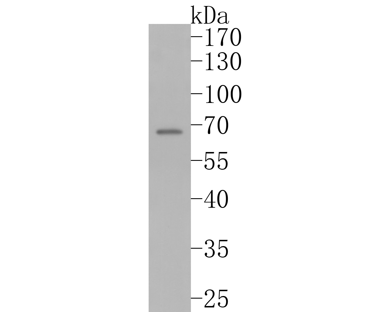 Western blot analysis of CRMP3 on SH-SY5Y cell lysates. Proteins were transferred to a PVDF membrane and blocked with 5% BSA in PBS for 1 hour at room temperature. The primary antibody (HA720021, 1/500) was used in 5% BSA at room temperature for 2 hours. Goat Anti-Rabbit IgG - HRP Secondary Antibody (HA1001) at 1:5,000 dilution was used for 1 hour at room temperature.