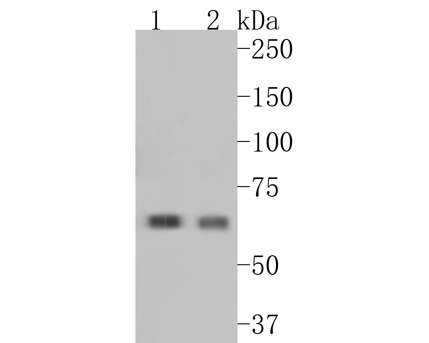 Western blot analysis of CRMP3 on different lysates. Proteins were transferred to a PVDF membrane and blocked with 5% BSA in PBS for 1 hour at room temperature. The primary antibody (HA720021, 1/2,000) was used in 5% BSA at room temperature for 2 hours. Goat Anti-Rabbit IgG - HRP Secondary Antibody (HA1001) at 1:5,000 dilution was used for 1 hour at room temperature.<br />
Positive control: <br />
Lane 1: Rat brain tissue lysate<br />
Lane 2: Mouse hippocampus tissue lysate