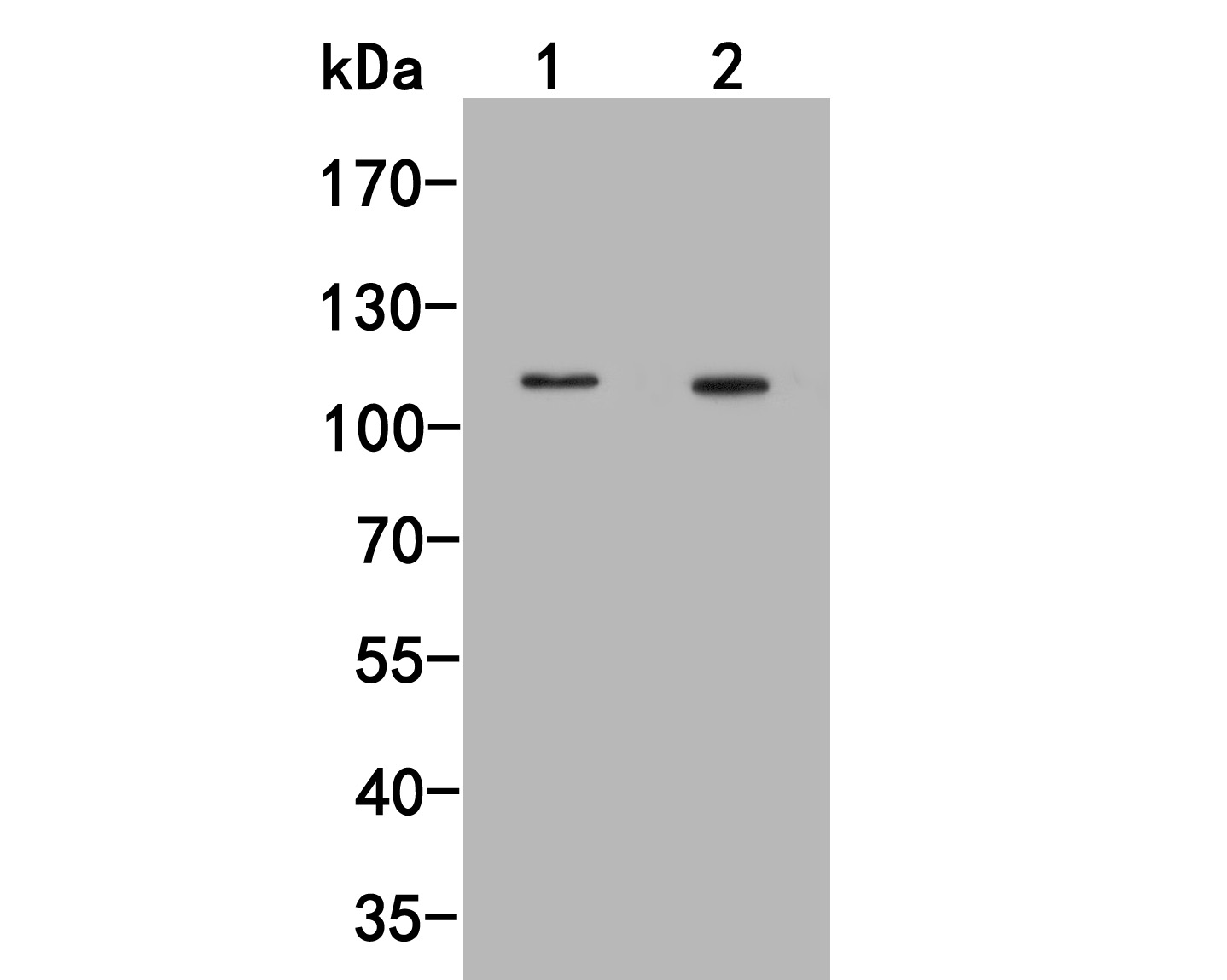 Western blot analysis of FAM62B on different lysates. Proteins were transferred to a PVDF membrane and blocked with 5% BSA in PBS for 1 hour at room temperature. The primary antibody (M1009-1, 1/500) was used in 5% BSA at room temperature for 2 hours. Goat Anti-Mouse IgG - HRP Secondary Antibody (HA1006) at 1:5,000 dilution was used for 1 hour at room temperature.<br />
Positive control: <br />
Lane 1: Siha cell lysate<br />
Lane 2: THP-1 cell lysate