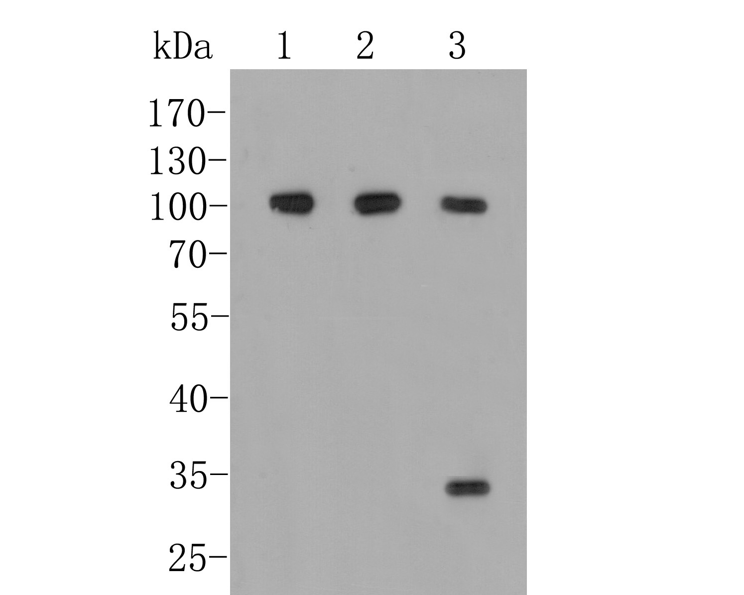 Immunohistochemical analysis of paraffin-embedded rat bladder tissue using anti-CD166 antibody. The section was pre-treated using heat mediated antigen retrieval with Tris-EDTA buffer (pH 8.0-8.4) for 20 minutes.The tissues were blocked in 5% BSA for 30 minutes at room temperature, washed with ddH2O and PBS, and then probed with the primary antibody (M1012-7, 1/100) for 30 minutes at room temperature. The detection was performed using an HRP conjugated compact polymer system. DAB was used as the chromogen. Tissues were counterstained with hematoxylin and mounted with DPX.