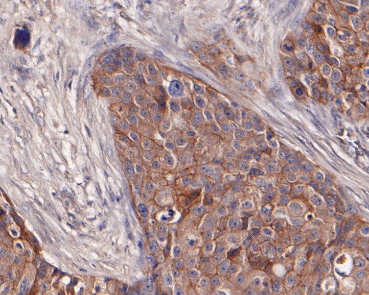 Immunohistochemical analysis of paraffin-embedded mouse liver tissue using anti-CD166 antibody. The section was pre-treated using heat mediated antigen retrieval with Tris-EDTA buffer (pH 8.0-8.4) for 20 minutes.The tissues were blocked in 5% BSA for 30 minutes at room temperature, washed with ddH2O and PBS, and then probed with the primary antibody (M1012-7, 1/50) for 30 minutes at room temperature. The detection was performed using an HRP conjugated compact polymer system. DAB was used as the chromogen. Tissues were counterstained with hematoxylin and mounted with DPX.