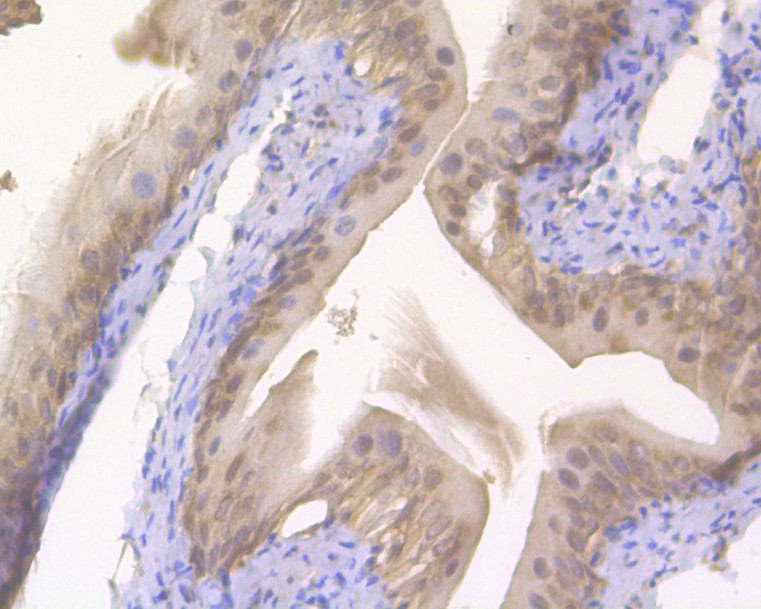Immunohistochemical analysis of paraffin-embedded rat bladder tissue using anti-S100A2 antibody. The section was pre-treated using heat mediated antigen retrieval with sodium citrate buffer (pH 6.0) for 20 minutes. The tissues were blocked in 5% BSA for 30 minutes at room temperature, washed with ddH2O and PBS, and then probed with the primary antibody (HA500044, 1/1,500)  for 30 minutes at room temperature. The detection was performed using an HRP conjugated compact polymer system. DAB was used as the chromogen. Tissues were counterstained with hematoxylin and mounted with DPX.