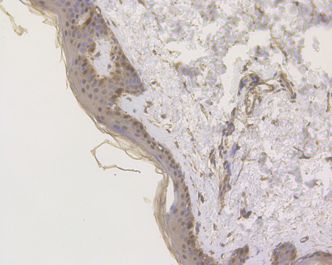 Immunohistochemical analysis of paraffin-embedded human skin tissue using anti-S100A2 antibody. The section was pre-treated using heat mediated antigen retrieval with sodium citrate buffer (pH 6.0) for 20 minutes. The tissues were blocked in 5% BSA for 30 minutes at room temperature, washed with ddH2O and PBS, and then probed with the primary antibody (HA500044, 1/1,000)  for 30 minutes at room temperature. The detection was performed using an HRP conjugated compact polymer system. DAB was used as the chromogen. Tissues were counterstained with hematoxylin and mounted with DPX.
