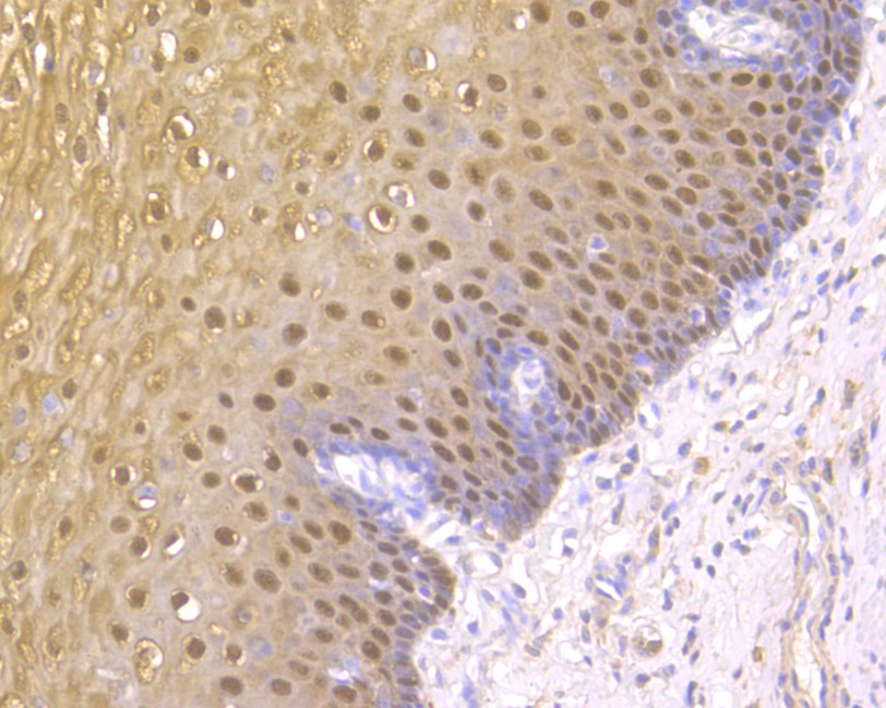 Immunohistochemical analysis of paraffin-embedded human esophagus tissue using anti-S100A2 antibody. The section was pre-treated using heat mediated antigen retrieval with sodium citrate buffer (pH 6.0) for 20 minutes. The tissues were blocked in 5% BSA for 30 minutes at room temperature, washed with ddH2O and PBS, and then probed with the primary antibody (HA500044, 1/1,500)  for 30 minutes at room temperature. The detection was performed using an HRP conjugated compact polymer system. DAB was used as the chromogen. Tissues were counterstained with hematoxylin and mounted with DPX.