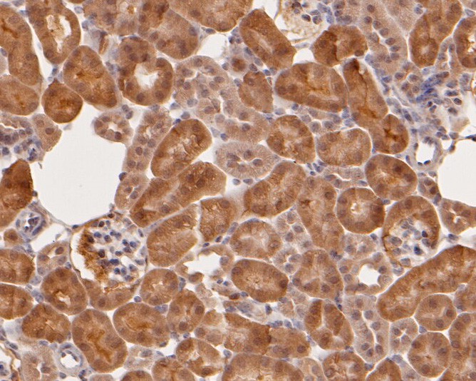 Immunohistochemical analysis of paraffin-embedded mouse kidney tissue using anti-S100A2 antibody. The section was pre-treated using heat mediated antigen retrieval with sodium citrate buffer (pH 6.0) for 20 minutes. The tissues were blocked in 5% BSA for 30 minutes at room temperature, washed with ddH2O and PBS, and then probed with the primary antibody (HA500044, 1/800)  for 30 minutes at room temperature. The detection was performed using an HRP conjugated compact polymer system. DAB was used as the chromogen. Tissues were counterstained with hematoxylin and mounted with DPX.