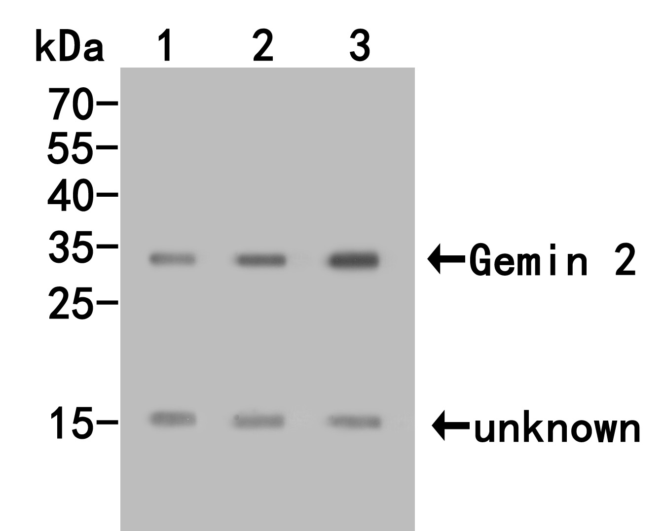 Western blot analysis of Gemin 2 on different lysates. Proteins were transferred to a PVDF membrane and blocked with 5% BSA in PBS for 1 hour at room temperature. The primary antibody (HA500045, 1/500) was used in 5% BSA at room temperature for 2 hours. Goat Anti-Rabbit IgG - HRP Secondary Antibody (HA1001) at 1:5,000 dilution was used for 1 hour at room temperature.<br />
Positive control: <br />
Lane 1: Hela cell lysate<br />
Lane 2: Jurkat cell lysate<br />
Lane 2: 293T cell lysate