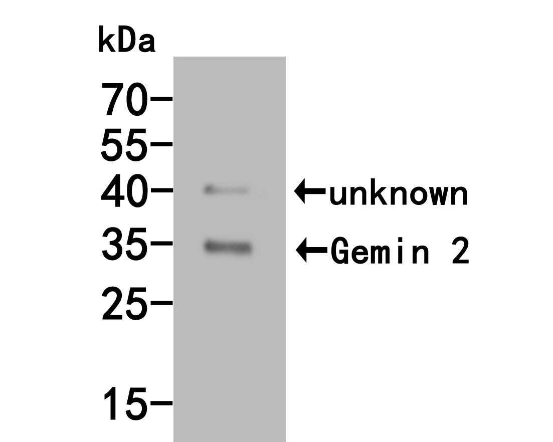 Western blot analysis of Gemin 2 on mouse kidney tissue lysates. Proteins were transferred to a PVDF membrane and blocked with 5% BSA in PBS for 1 hour at room temperature. The primary antibody (HA500045, 1/500) was used in 5% BSA at room temperature for 2 hours. Goat Anti-Rabbit IgG - HRP Secondary Antibody (HA1001) at 1:5,000 dilution was used for 1 hour at room temperature.