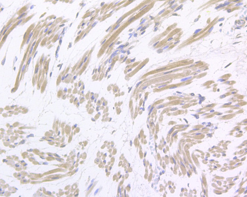 Immunohistochemical analysis of paraffin-embedded human skeletal muscle tissue using anti-Gemin 2 antibody. The section was pre-treated using heat mediated antigen retrieval with sodium citrate buffer (pH 6.0) for 20 minutes. The tissues were blocked in 5% BSA for 30 minutes at room temperature, washed with ddH2O and PBS, and then probed with the primary antibody (HA500045, 1/400)  for 30 minutes at room temperature. The detection was performed using an HRP conjugated compact polymer system. DAB was used as the chromogen. Tissues were counterstained with hematoxylin and mounted with DPX.