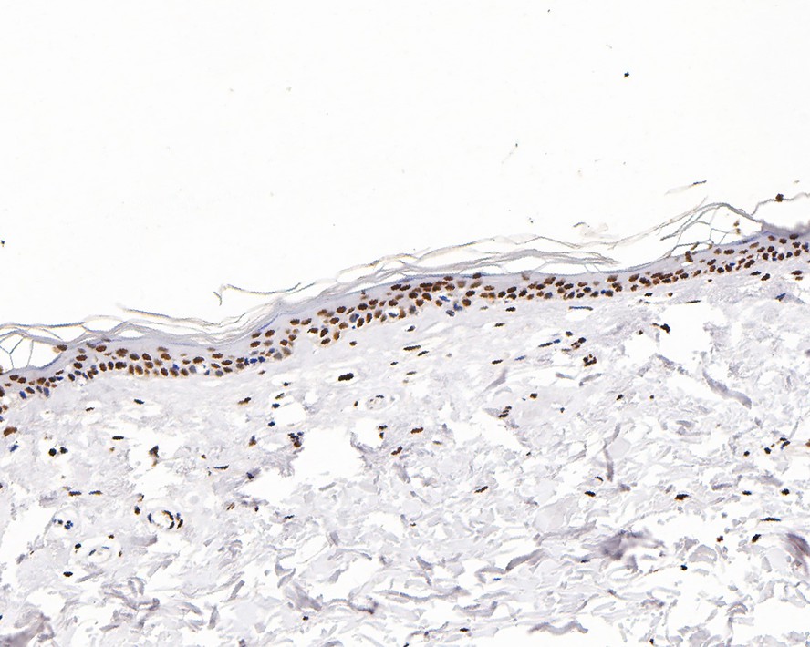 Immunohistochemical analysis of paraffin-embedded mouse colon tissue with Rabbit anti-Histone H3 (acetyl K27) antibody (HA500046) at 1/1,000 dilution.<br />
<br />
The section was pre-treated using heat mediated antigen retrieval with sodium citrate buffer (pH 6.0) for 2 minutes. The tissues were blocked in 1% BSA for 20 minutes at room temperature, washed with ddH2O and PBS, and then probed with the primary antibody (HA500046) at 1/1,000 dilution for 1 hour at room temperature. The detection was performed using an HRP conjugated compact polymer system. DAB was used as the chromogen. Tissues were counterstained with hematoxylin and mounted with DPX.