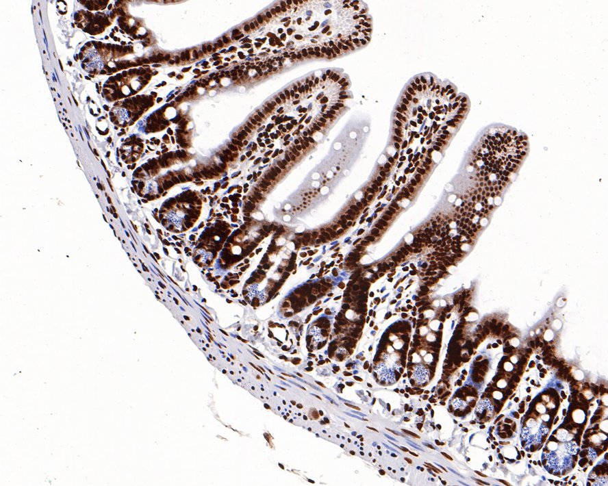 Immunohistochemical analysis of paraffin-embedded human colon tissue using anti-Histone H3 (acetyl K27) antibody. The section was pre-treated using heat mediated antigen retrieval with sodium citrate buffer (pH 6.0) for 20 minutes. The tissues were blocked in 5% BSA for 30 minutes at room temperature, washed with ddH2O and PBS, and then probed with the primary antibody (HA500046, 1/500) for 30 minutes at room temperature. The detection was performed using an HRP conjugated compact polymer system. DAB was used as the chromogen. Tissues were counterstained with hematoxylin and mounted with DPX.