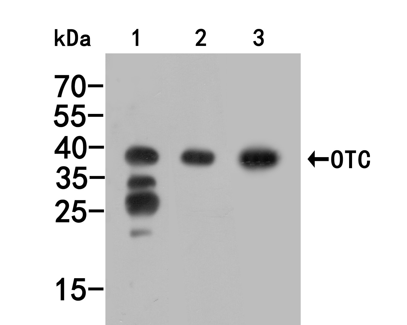 Western blot analysis of OTC/Ornithine Carbamoyltransferase on different lysates. Proteins were transferred to a PVDF membrane and blocked with 5% BSA in PBS for 1 hour at room temperature. The primary antibody (HA500048, 1/500) was used in 5% BSA at room temperature for 2 hours. Goat Anti-Rabbit IgG - HRP Secondary Antibody (HA1001) at 1:5,000 dilution was used for 1 hour at room temperature.<br />
Positive control: <br />
Lane 1: Rat colon tissue lysate<br />
Lane 2: Human liver tissue lysate<br />
Lane 2: Mouse liver tissue lysate