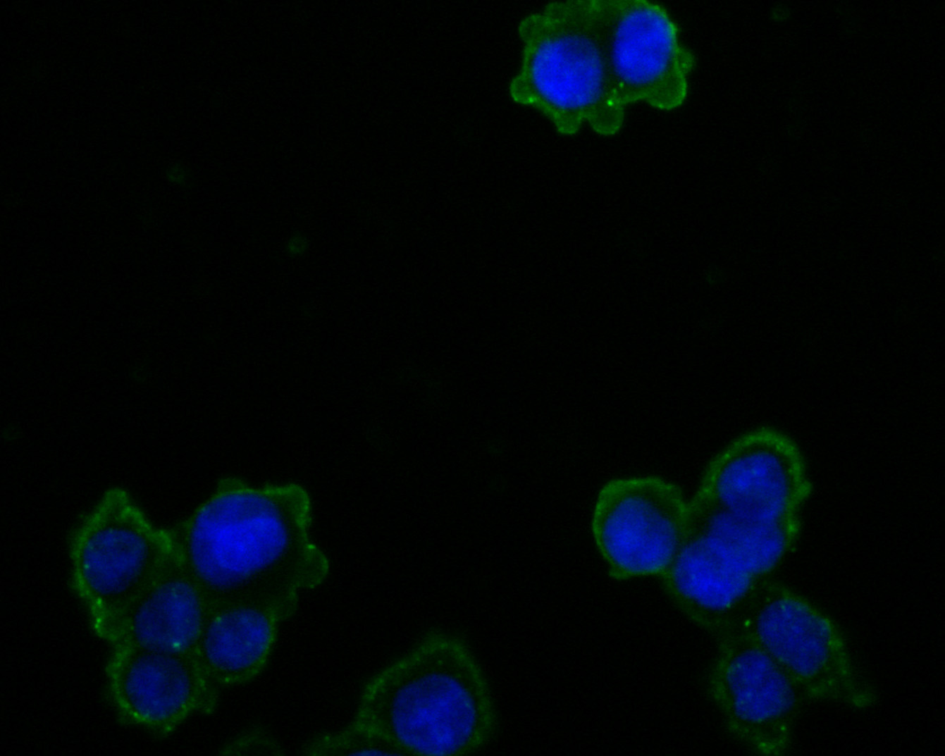 ICC staining of OTC/Ornithine Carbamoyltransferase in SW480 cells (green). Formalin fixed cells were permeabilized with 0.1% Triton X-100 in TBS for 10 minutes at room temperature and blocked with 1% Blocker BSA for 15 minutes at room temperature. Cells were probed with the primary antibody (HA500048, 1/100) for 1 hour at room temperature, washed with PBS. Alexa Fluor®488 Goat anti-Rabbit IgG was used as the secondary antibody at 1/1,000 dilution. The nuclear counter stain is DAPI (blue).