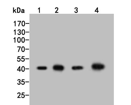 Western blot analysis of ADK on different lysates. Proteins were transferred to a PVDF membrane and blocked with 5% BSA in PBS for 1 hour at room temperature. The primary antibody (HA500050, 1/500) was used in 5% BSA at room temperature for 2 hours. Goat Anti-Rabbit IgG - HRP Secondary Antibody (HA1001) at 1:5,000 dilution was used for 1 hour at room temperature.<br />
Positive control: <br />
Lane 1: LO2 cell lysate<br />
Lane 2: A431 cell lysate<br />
Lane 1: Mouse testis tissue lysate<br />
Lane 1: Rat kidney tissue lysate