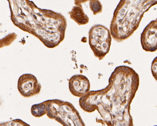 Immunohistochemical analysis of paraffin-embedded human placenta tissue using anti-ADK antibody. The section was pre-treated using heat mediated antigen retrieval with sodium citrate buffer (pH 6.0) for 20 minutes. The tissues were blocked in 5% BSA for 30 minutes at room temperature, washed with ddH2O and PBS, and then probed with the primary antibody (HA500050, 1/800)  for 30 minutes at room temperature. The detection was performed using an HRP conjugated compact polymer system. DAB was used as the chromogen. Tissues were counterstained with hematoxylin and mounted with DPX.