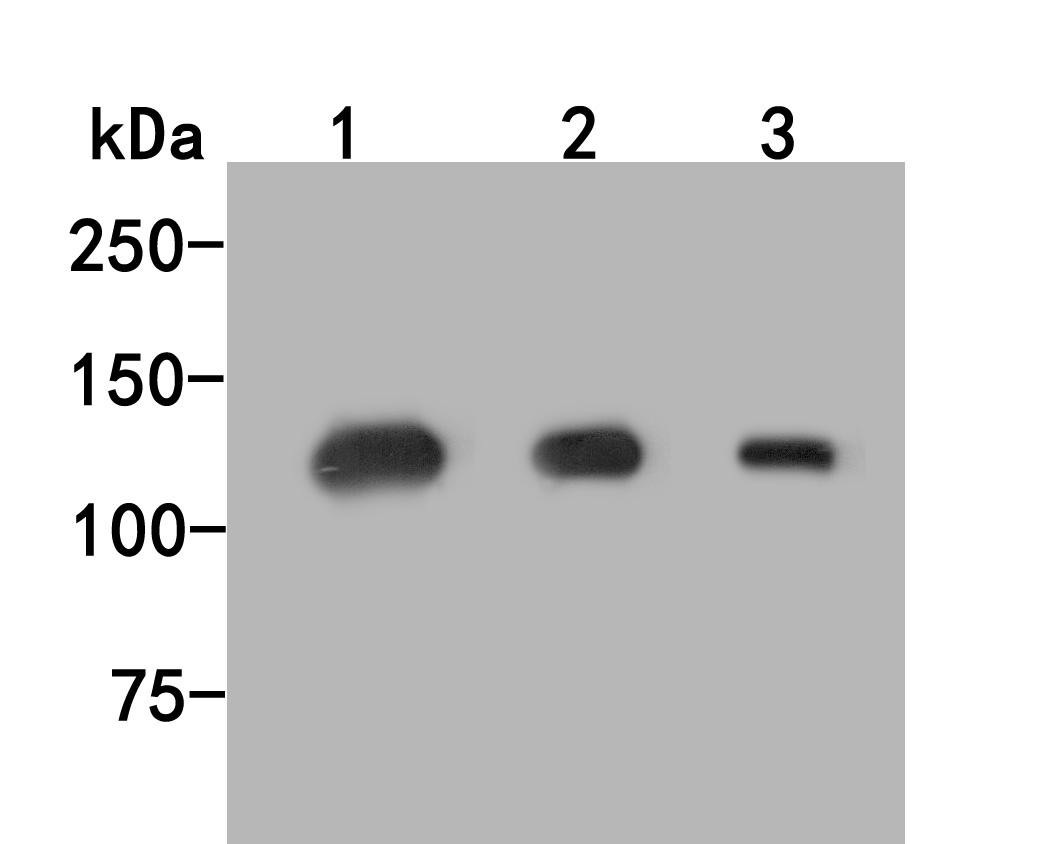 Western blot analysis of Munc13-4 on different lysates. Proteins were transferred to a PVDF membrane and blocked with 5% BSA in PBS for 1 hour at room temperature. The primary antibody (HA500052, 1/500) was used in 5% BSA at room temperature for 2 hours. Goat Anti-Rabbit IgG - HRP Secondary Antibody (HA1001) at 1:5,000 dilution was used for 1 hour at room temperature.<br />
Positive control: <br />
Lane 1: Jurkat cell lysate<br />
Lane 2: K562 cell lysate<br />
Lane 3: Rat lung tissue lysate