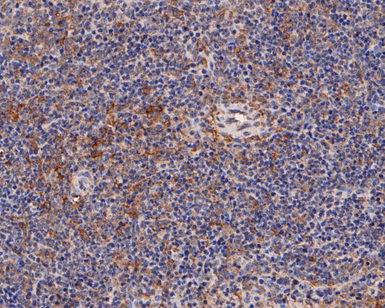 Immunohistochemical analysis of paraffin-embedded rat spleen tissue using anti-Munc13-4 antibody. The section was pre-treated using heat mediated antigen retrieval with Tris-EDTA buffer (pH 8.0-8.4) for 20 minutes.The tissues were blocked in 5% BSA for 30 minutes at room temperature, washed with ddH2O and PBS, and then probed with the primary antibody (HA500052, 1/100) for 30 minutes at room temperature. The detection was performed using an HRP conjugated compact polymer system. DAB was used as the chromogen. Tissues were counterstained with hematoxylin and mounted with DPX.