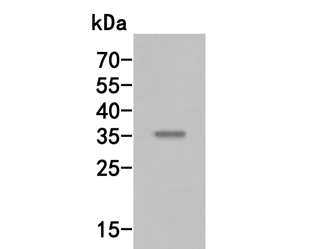 Western blot analysis of MEOX2 on rat kidney tissue lysates. Proteins were transferred to a PVDF membrane and blocked with 5% BSA in PBS for 1 hour at room temperature. The primary antibody (HA500053, 1/500) was used in 5% BSA at room temperature for 2 hours. Goat Anti-Rabbit IgG - HRP Secondary Antibody (HA1001) at 1:5,000 dilution was used for 1 hour at room temperature.