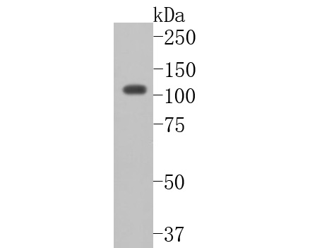 Cadherin 10 Rabbit Polyclonal Antibody - image 1