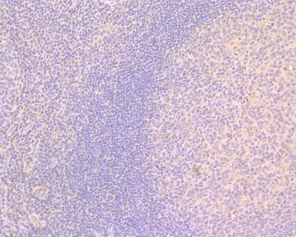 Immunohistochemical analysis of paraffin-embedded human tonsil tissue using anti-Scramblase 1 antibody. The section was pre-treated using heat mediated antigen retrieval with sodium citrate buffer (pH 6.0) for 20 minutes. The tissues were blocked in 5% BSA for 30 minutes at room temperature, washed with ddH2O and PBS, and then probed with the primary antibody (HA500063, 1/200)  for 30 minutes at room temperature. The detection was performed using an HRP conjugated compact polymer system. DAB was used as the chromogen. Tissues were counterstained with hematoxylin and mounted with DPX.