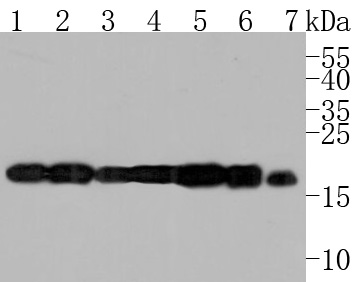 Western blot analysis of ARF4 on different lysates. Proteins were transferred to a PVDF membrane and blocked with 5% BSA in PBS for 1 hour at room temperature. The primary antibody (HA500066, 1/500) was used in 5% BSA at room temperature for 2 hours. Goat Anti-Rabbit IgG - HRP Secondary Antibody (HA1001) at 1:5,000 dilution was used for 1 hour at room temperature.<br />
Positive control: <br />
Lane 1: HepG2 cell lysate<br />
Lane 2: Hela cell lysate<br />
Lane 3: Mouse kidney tissue lysate<br />
Lane 4: MCF-7 cell lysate<br />
Lane 5: HepG2 cell lysate<br />
Lane 6: Mouse cerebellum tissue lysate<br />
Lane 7: Rat testis tissue lysate