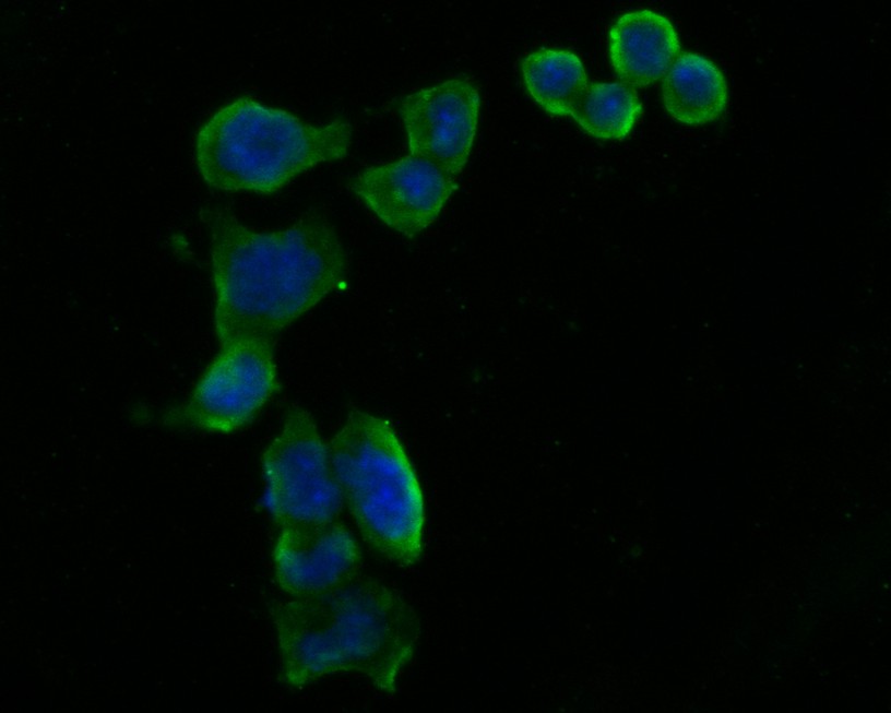 ICC staining of ARF4 in F9 cells (green). Formalin fixed cells were permeabilized with 0.1% Triton X-100 in TBS for 10 minutes at room temperature and blocked with 1% Blocker BSA for 15 minutes at room temperature. Cells were probed with the primary antibody (HA500066, 1/50) for 1 hour at room temperature, washed with PBS. Alexa Fluor®488 Goat anti-Rabbit IgG was used as the secondary antibody at 1/1,000 dilution. The nuclear counter stain is DAPI (blue).