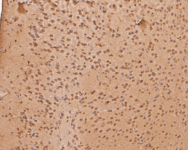 Immunohistochemical analysis of paraffin-embedded mouse brain tissue using anti-PHLDA1 antibody. The section was pre-treated using heat mediated antigen retrieval with sodium citrate buffer (pH 6.0) for 20 minutes. The tissues were blocked in 5% BSA for 30 minutes at room temperature, washed with ddH2O and PBS, and then probed with the primary antibody (HA500068, 1/400)  for 30 minutes at room temperature. The detection was performed using an HRP conjugated compact polymer system. DAB was used as the chromogen. Tissues were counterstained with hematoxylin and mounted with DPX.