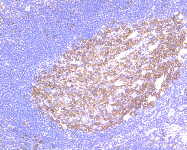 Immunohistochemical analysis of paraffin-embedded human tonsil tissue using anti-RanBP1 antibody. The section was pre-treated using heat mediated antigen retrieval with sodium citrate buffer (pH 6.0) for 20 minutes. The tissues were blocked in 5% BSA for 30 minutes at room temperature, washed with ddH2O and PBS, and then probed with the primary antibody (HA500069, 1/1,000)  for 30 minutes at room temperature. The detection was performed using an HRP conjugated compact polymer system. DAB was used as the chromogen. Tissues were counterstained with hematoxylin and mounted with DPX.