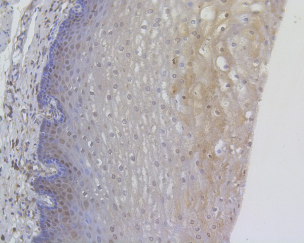 Immunohistochemical analysis of paraffin-embedded human esophagus tissue using anti-RanBP1 antibody. The section was pre-treated using heat mediated antigen retrieval with sodium citrate buffer (pH 6.0) for 20 minutes. The tissues were blocked in 5% BSA for 30 minutes at room temperature, washed with ddH2O and PBS, and then probed with the primary antibody (HA500069, 1/1,000)  for 30 minutes at room temperature. The detection was performed using an HRP conjugated compact polymer system. DAB was used as the chromogen. Tissues were counterstained with hematoxylin and mounted with DPX.