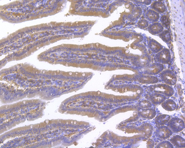 Immunohistochemical analysis of paraffin-embedded mouse intestine tissue using anti-RanBP1 antibody. The section was pre-treated using heat mediated antigen retrieval with sodium citrate buffer (pH 6.0) for 20 minutes. The tissues were blocked in 5% BSA for 30 minutes at room temperature, washed with ddH2O and PBS, and then probed with the primary antibody (HA500069, 1/1,000)  for 30 minutes at room temperature. The detection was performed using an HRP conjugated compact polymer system. DAB was used as the chromogen. Tissues were counterstained with hematoxylin and mounted with DPX.